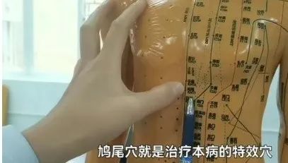 鸠尾穴是治疗癫痫病的特效穴