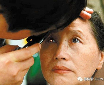 蜂蜜竟然可以治疗急性青光眼